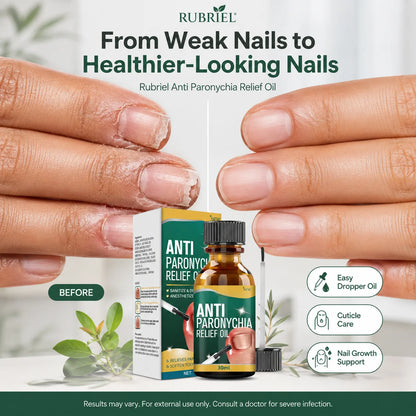Anti paronychia nail oil 30ml pack of 2