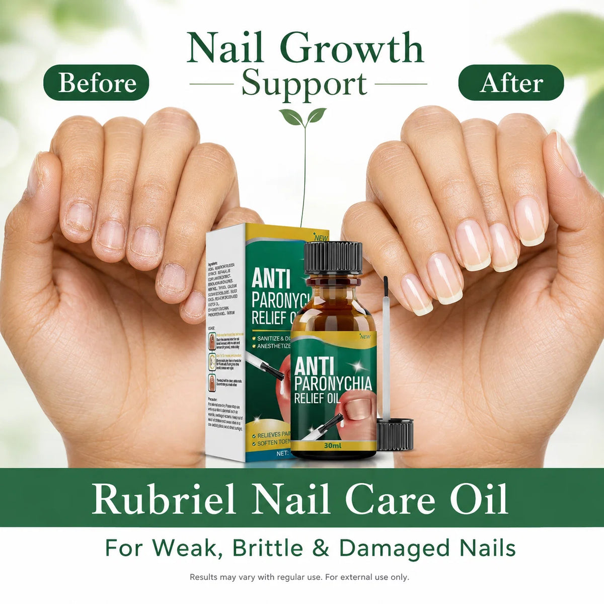 Anti paronychia nail oil 30ml pack of 2