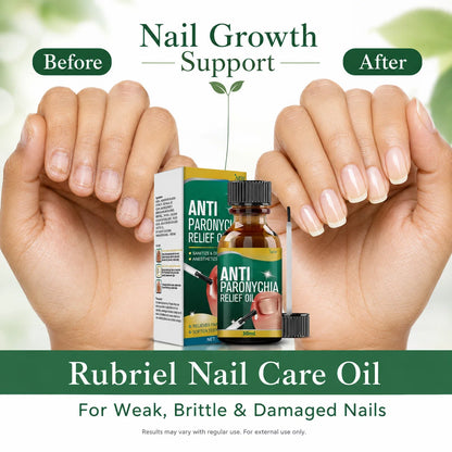 Anti paronychia nail oil 30ml pack of 2