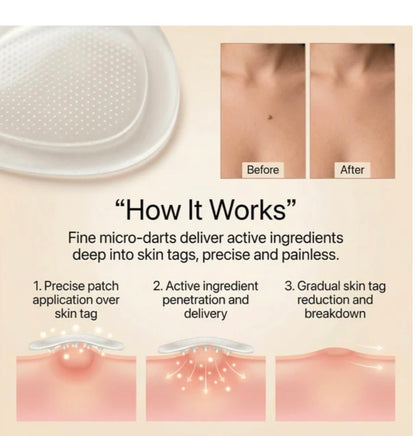 DermaSmooth - Tag &amp; Mole Remover
