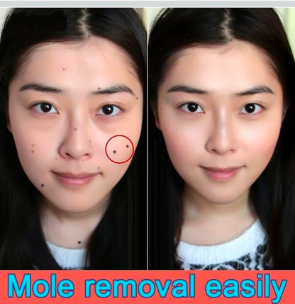 massa remover gel ( 100g ) pack of 1