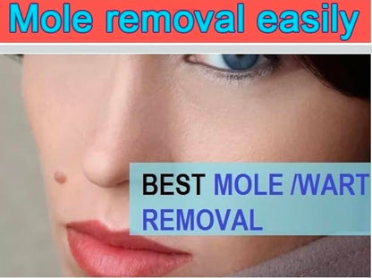 massa remover gel ( 100g ) pack of 1