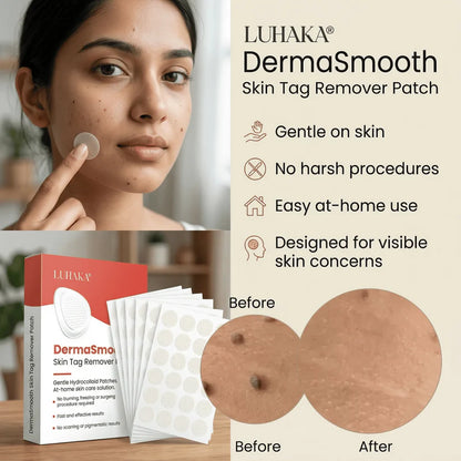 DermaSmooth - Tag &amp; Mole Remover